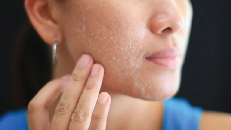How To Lighten Skin Easily 